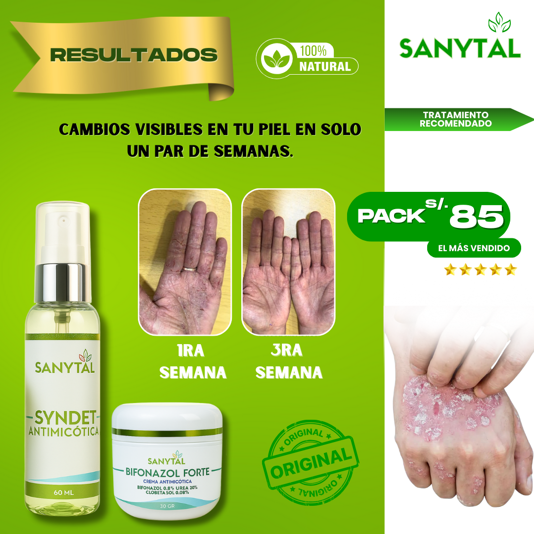 PACK ELIMINA LA TIÑA: BIFONAZOL FORTE 3 EN 1 + JABON ANTIMICOTICO (SYNDET) - B02