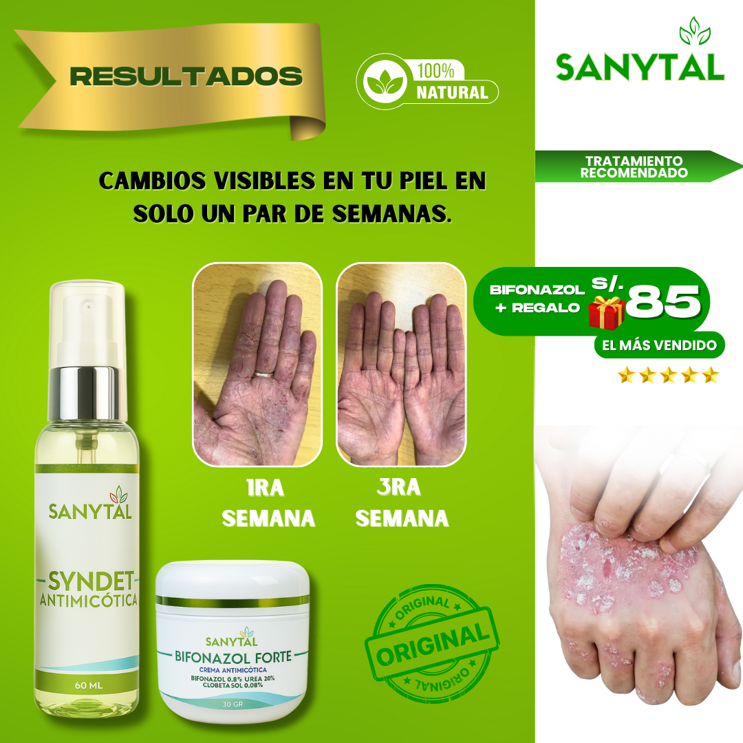 BIFONAZOL FORTE  (ELIMINA TIÑA E INFECCIONES POR HONGO EN LA PIEL)+ JABÓN ANTIMICOTICO SYNDET DE REGALO- - B04