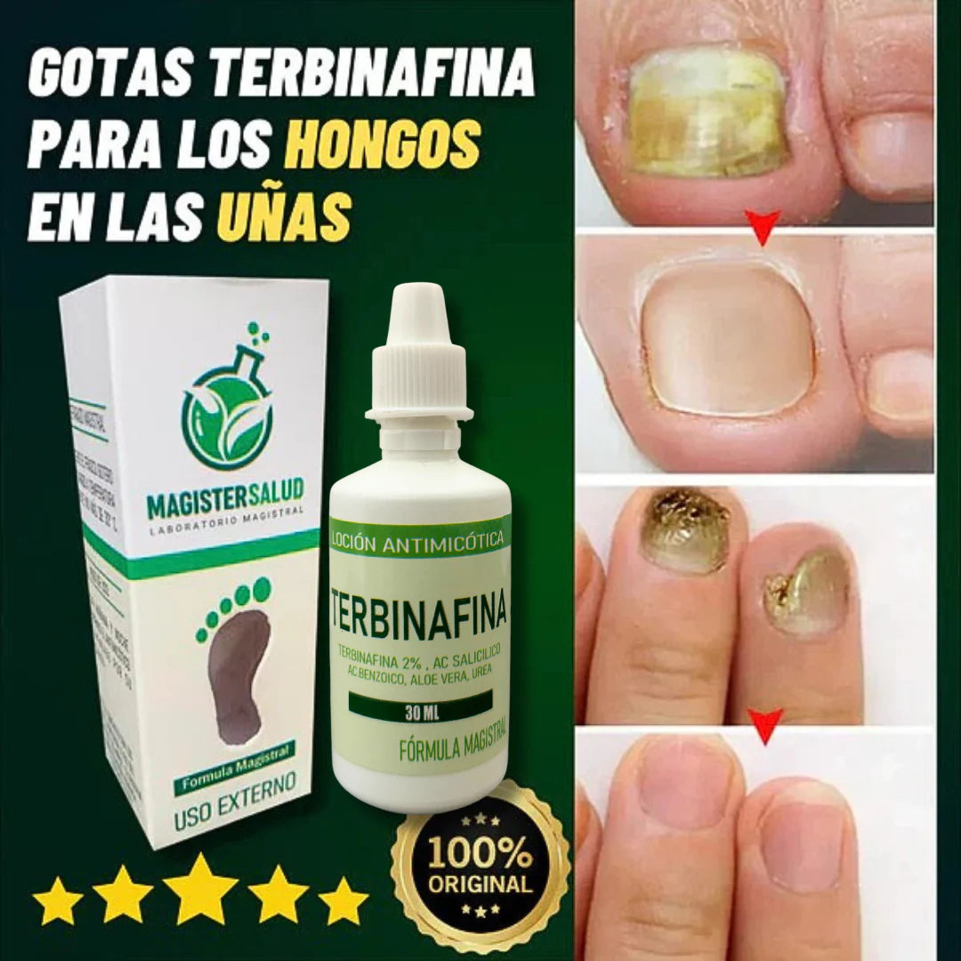 PACK: TERBINAFINA + TALCO ANTIMICÓTICO (ELIMINA HONGOS EN LAS UÑAS Y PIE DE ATLETA) - S033