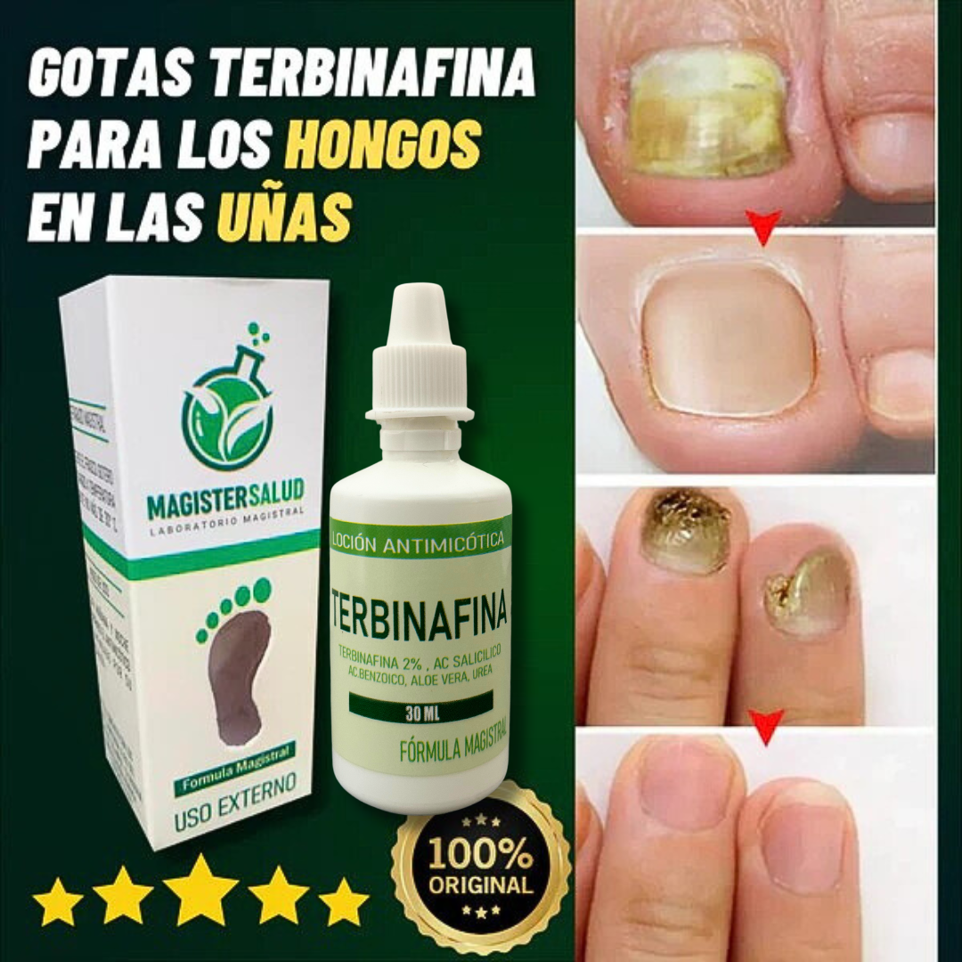 GOTAS DE TERBINAFINA QUITA HONGOS - S007