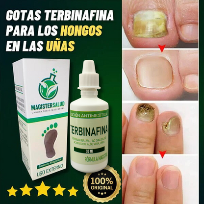 GOTAS DE TERBINAFINA QUITA HONGOS - S007