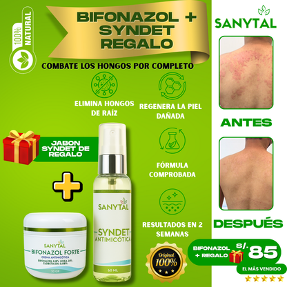 BIFONAZOL FORTE  (ELIMINA TIÑA E INFECCIONES POR HONGO EN LA PIEL)+ JABÓN ANTIMICOTICO SYNDET DE REGALO- - B04