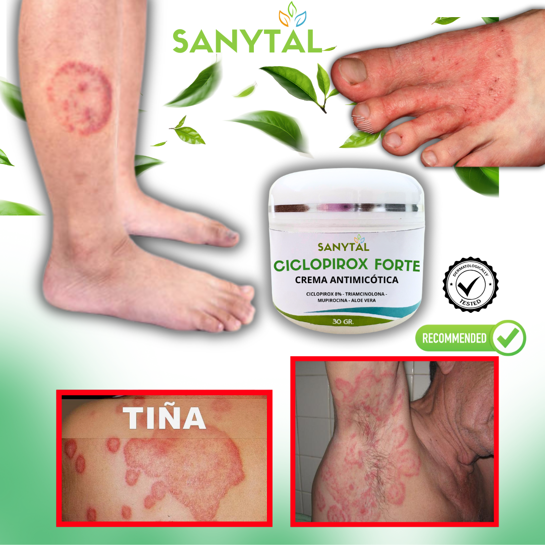 CICLOPIROX FORTE 8%- ELIMINA LA TIÑA INGUINAL- S014